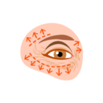 Phẫu thuật Mắt