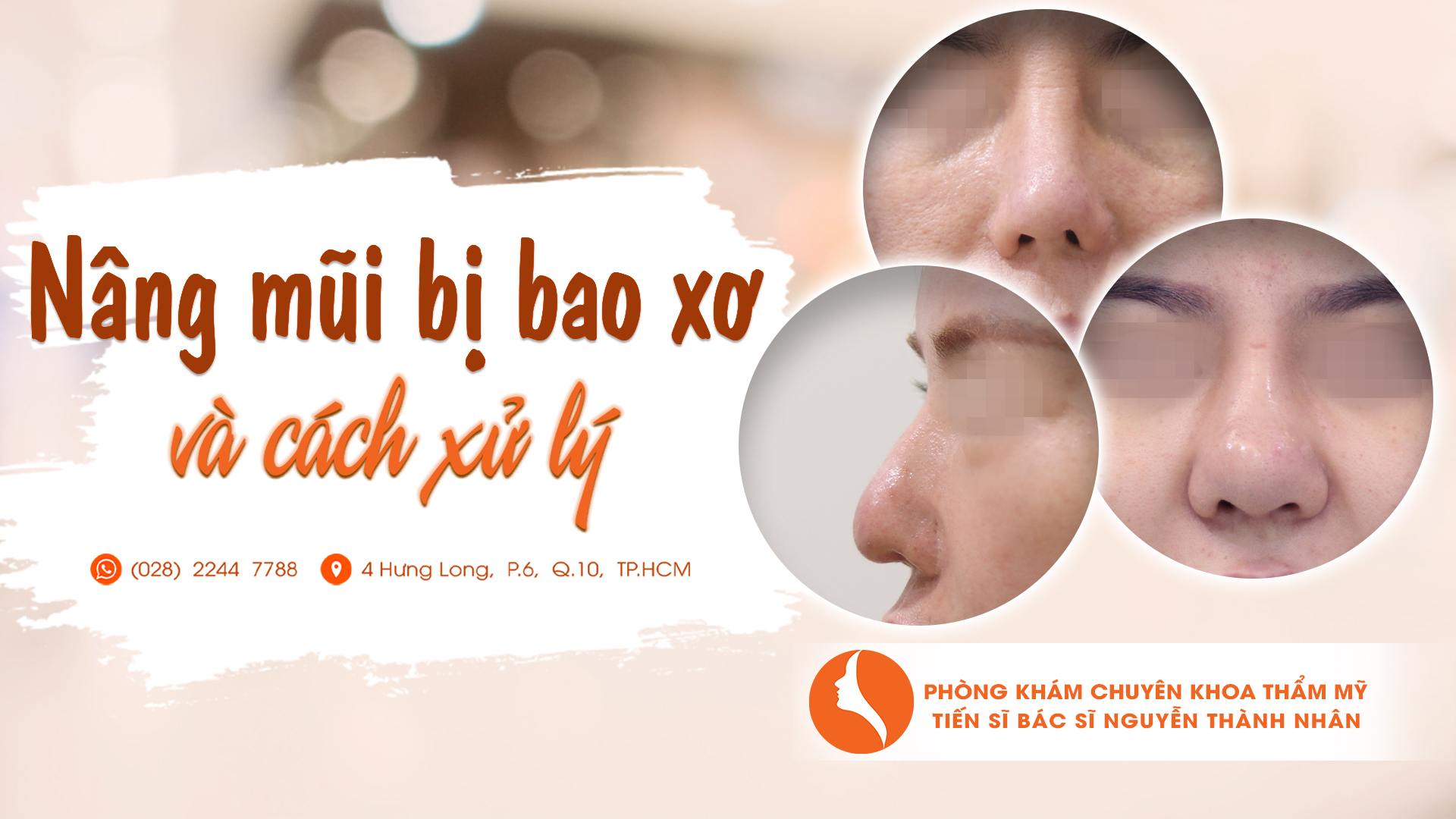 Mơ Thấy Sửa Mũi Bị Hư: Giải Mã Giấc Mơ và Hành Trình Tái Tạo Vẻ Đẹp